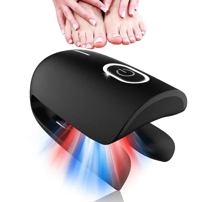 Laser Treatment Device for Toenail Fungus Therapy