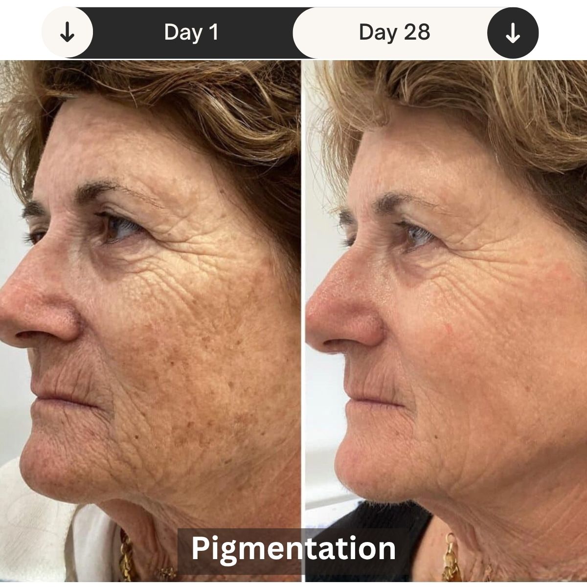 LED Skin Rejuvenation Therapy Device for Professional Use