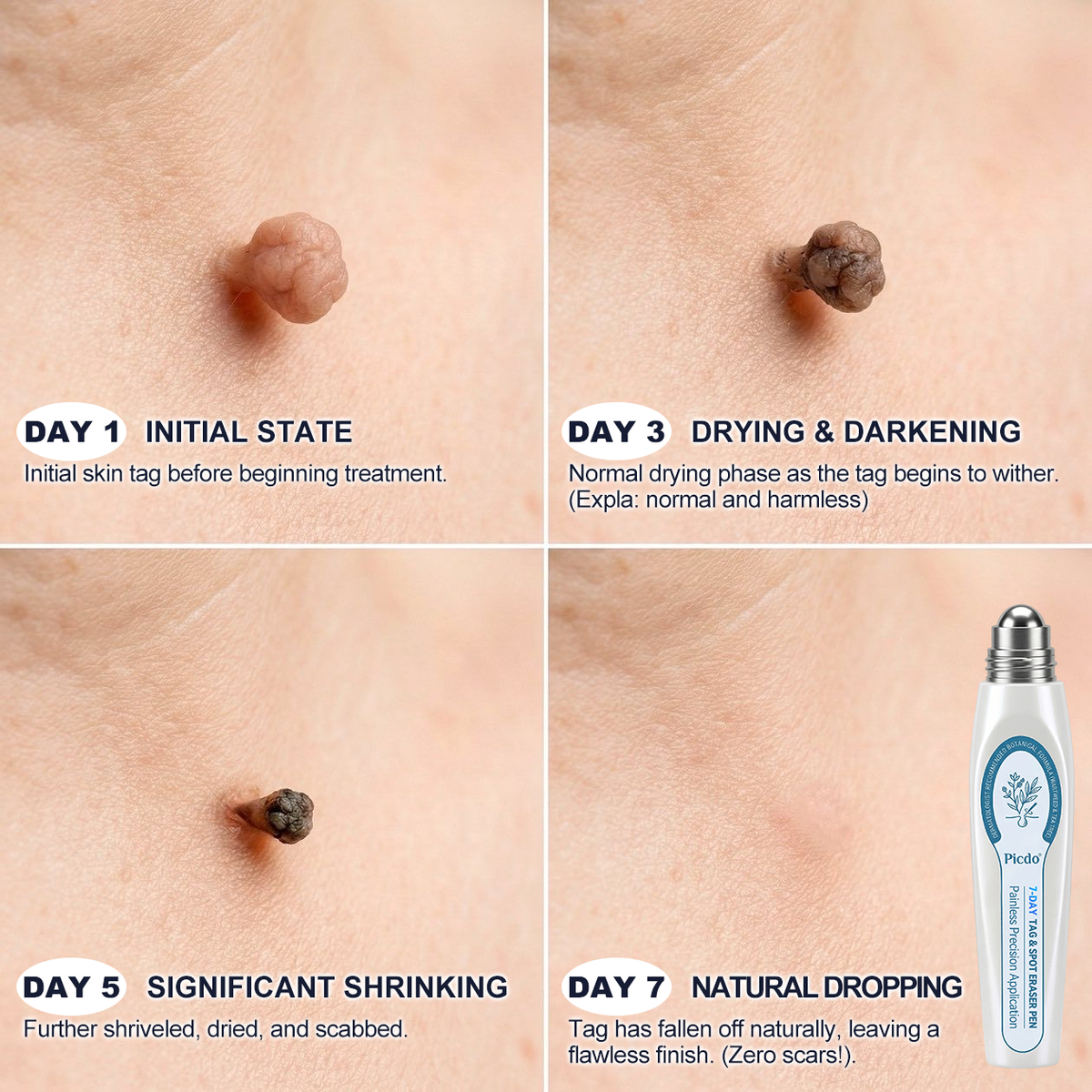 GlowVive — Reveal Radiant, Blemish-Free Skin in Just 7 Days Without Pain or Scars