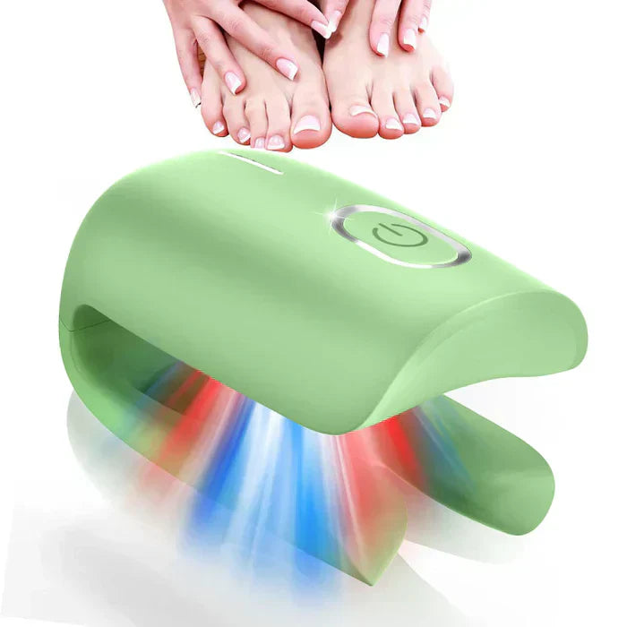 Laser Treatment Device for Toenail Fungus Therapy