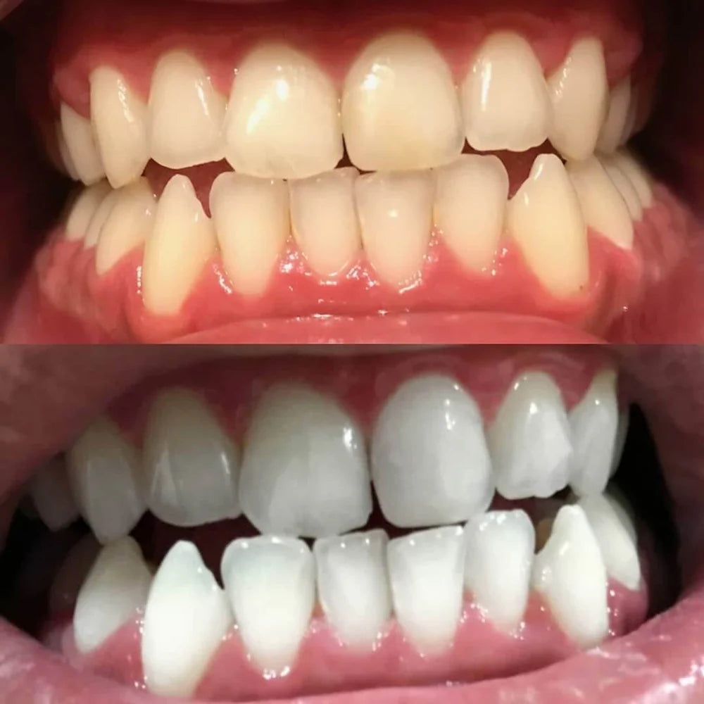 LumaLux — Instantly Boost Your Confidence with a Brighter, Radiant Smile