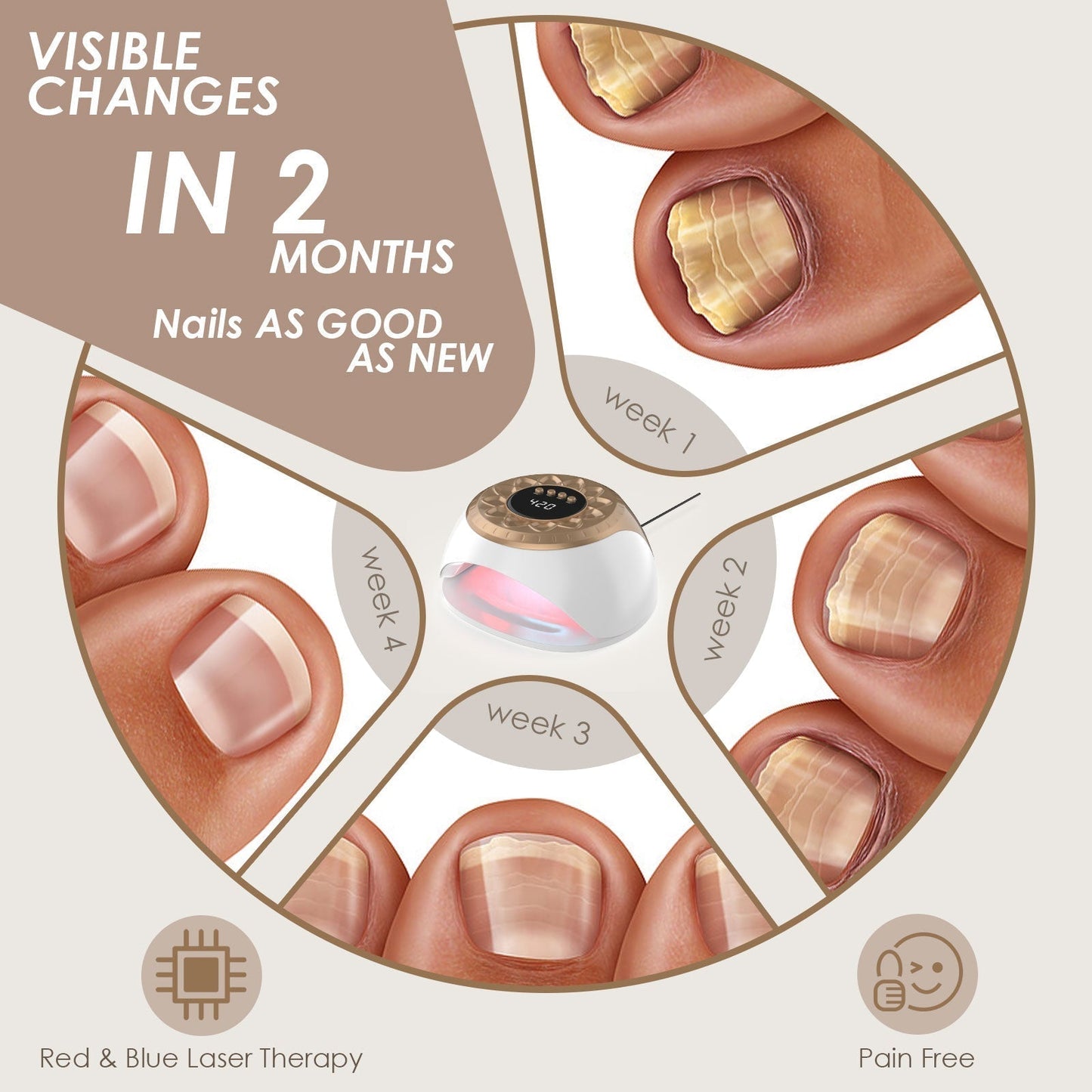 Device for Treating Toenail Fungus with Gold Light Technology
