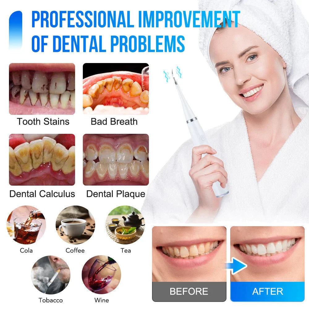 SmilePulse Ultrasonic Dental Cleaner for Plaque and Tartar Removal