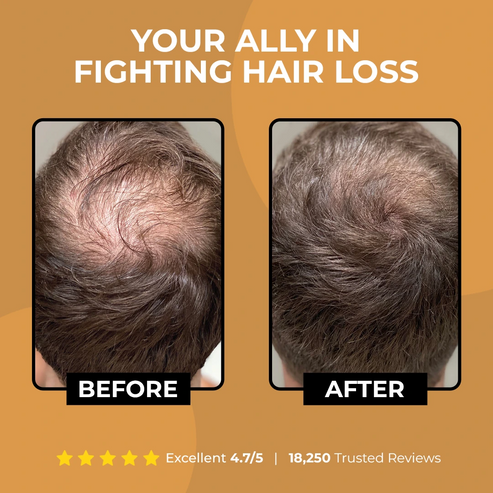Root Activator Shampoo 2.0