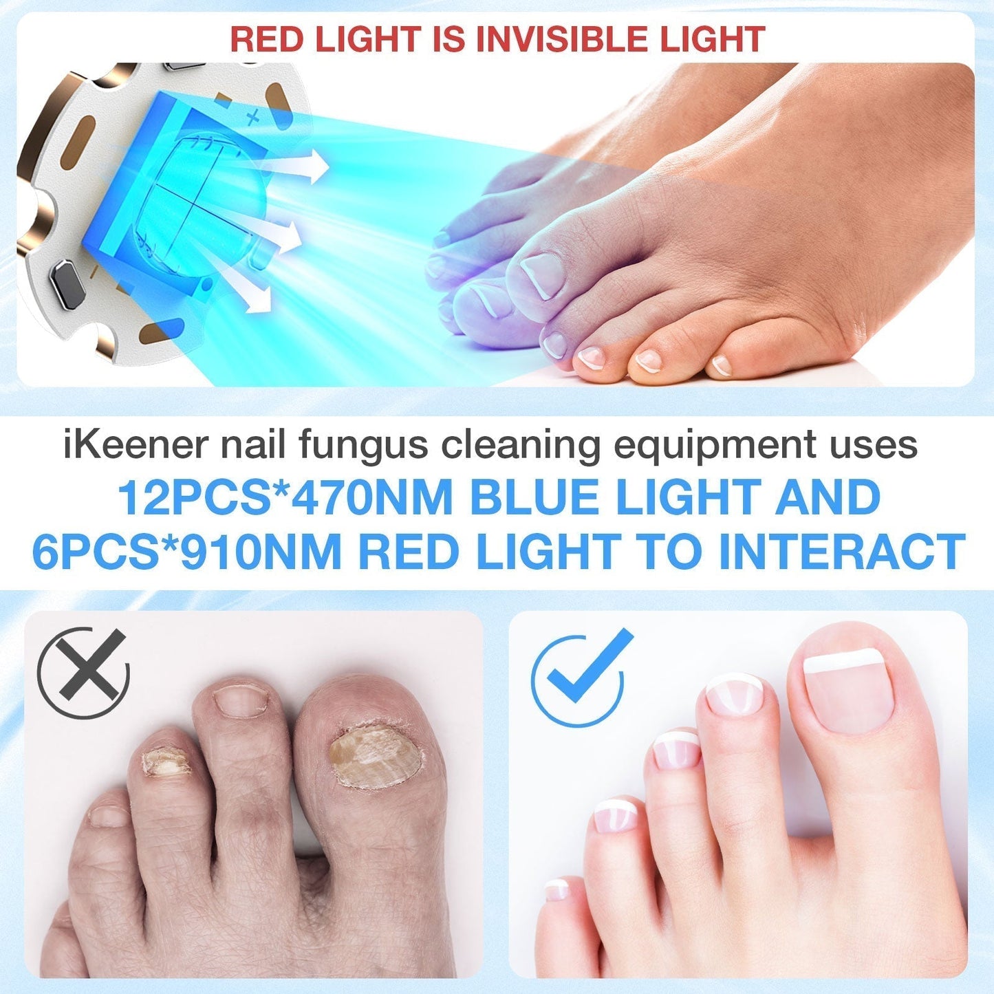 Home Device for Treating Nail Fungus on Multiple Toenails