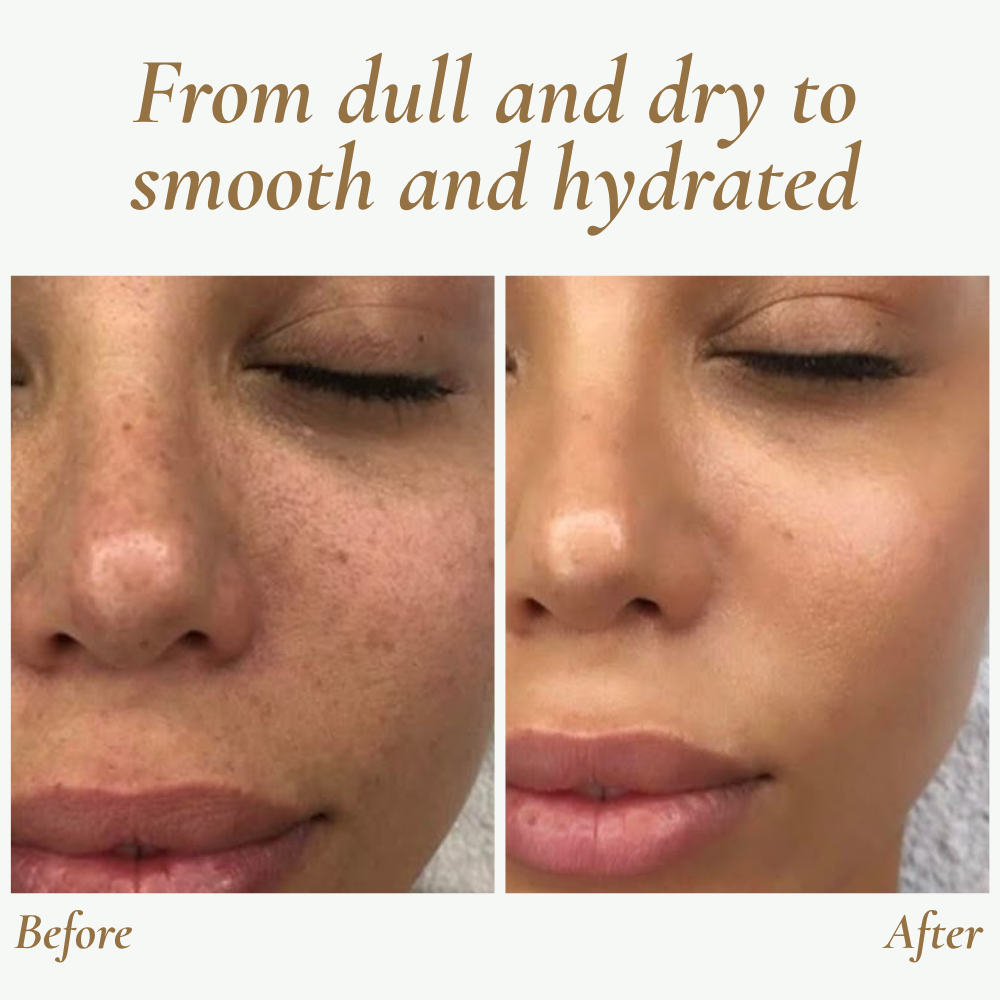 SkinPulse Ultrasonic Skin Scrubber for Deep Cleansing