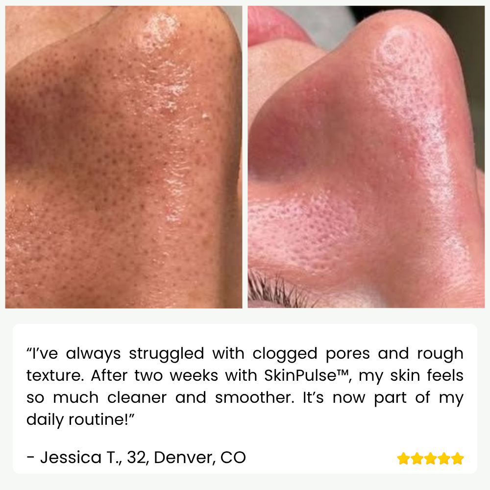 SkinPulse Ultrasonic Skin Scrubber for Deep Cleansing