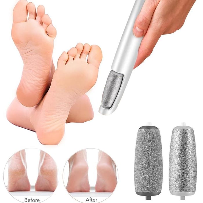 Electric Foot Callus Remover for Smooth Heels