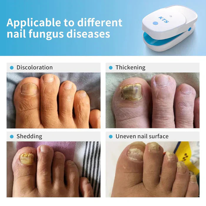 Nail Fungus Laser Therapy Device Starter Set