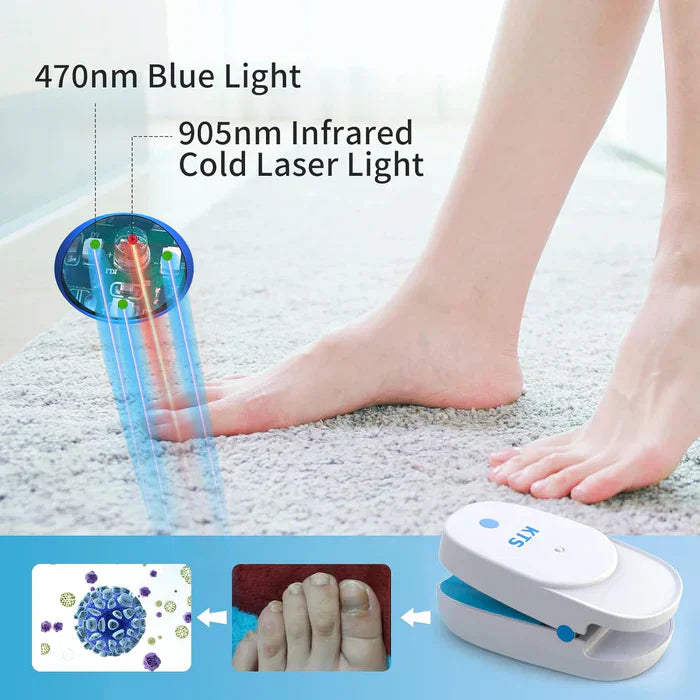 Nail Fungus Laser Therapy Device Starter Set