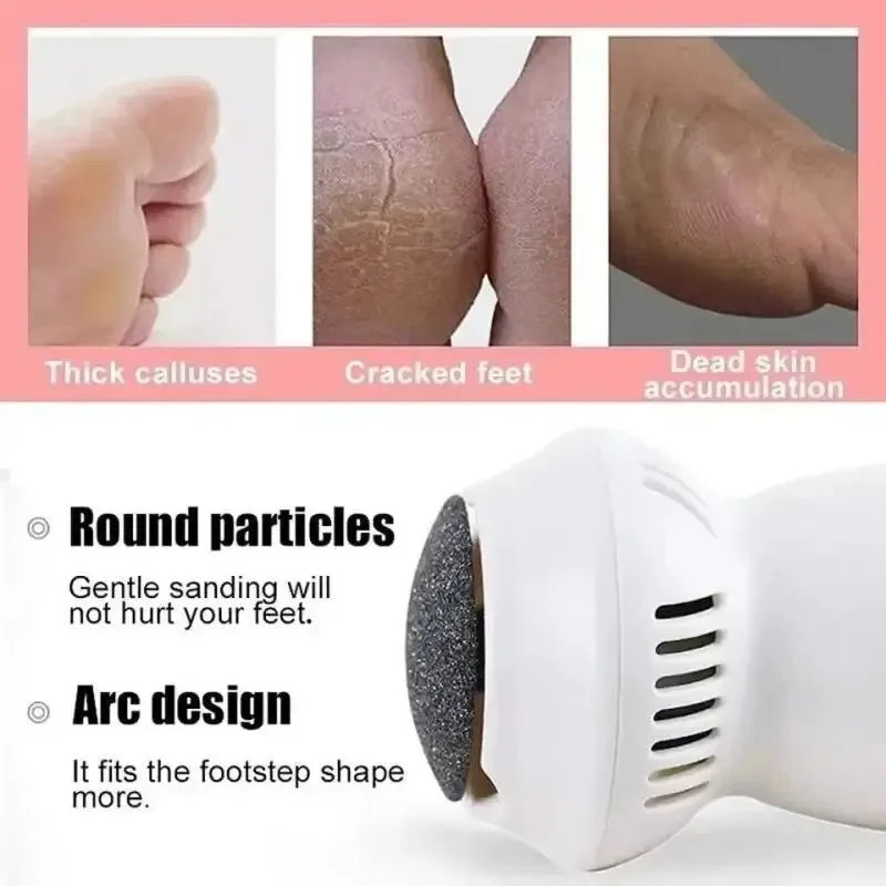 Efficient Electric Callus Remover for Smooth Feet