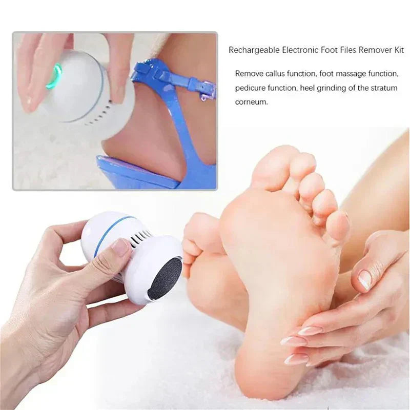 Efficient Electric Callus Remover for Smooth Feet