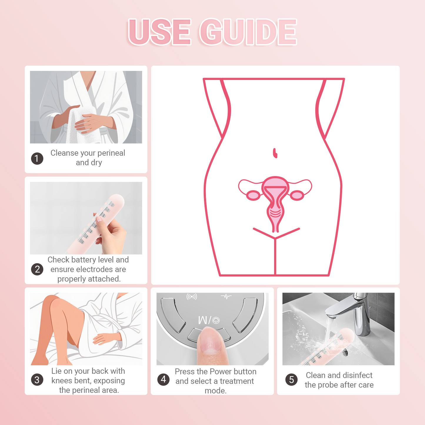 Device for Women's Incontinence Treatment During Postpartum Recovery
