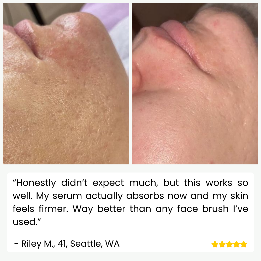 SkinPulse Ultrasonic Skin Scrubber for Deep Cleansing