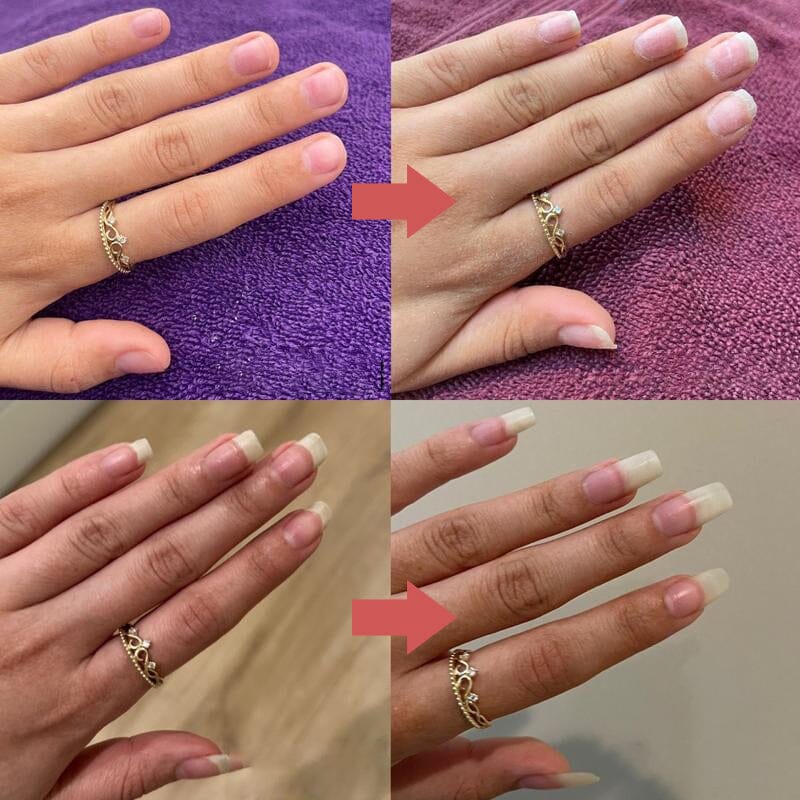 Nutrient-Rich Nail Growth Oil for Strong Cuticles