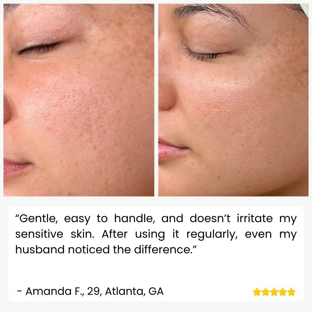 SkinPulse Ultrasonic Skin Scrubber for Deep Cleansing