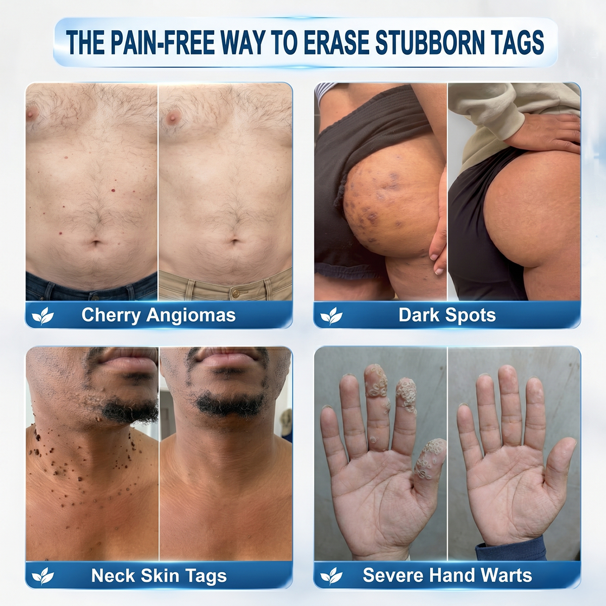 GlowVive — Reveal Radiant, Blemish-Free Skin in Just 7 Days Without Pain or Scars