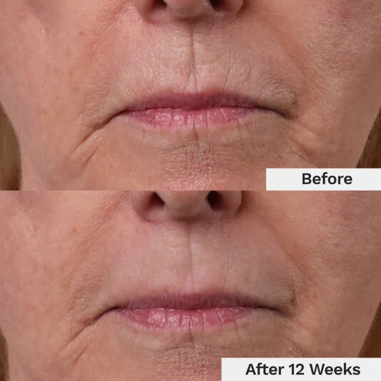 Luxevéria Youth-Restore Lip Wrinkle Cream