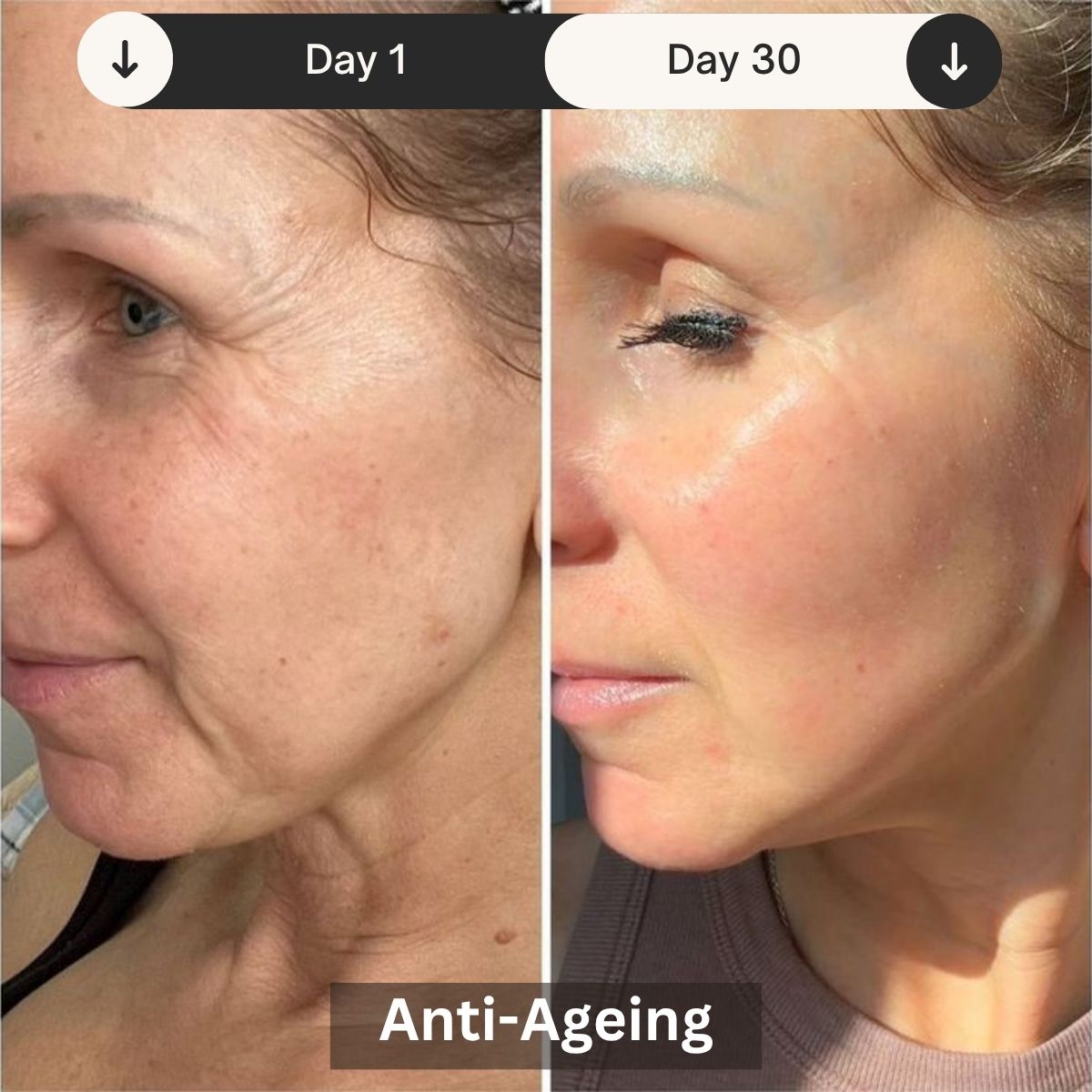 LED Skin Rejuvenation Therapy Device for Professional Use