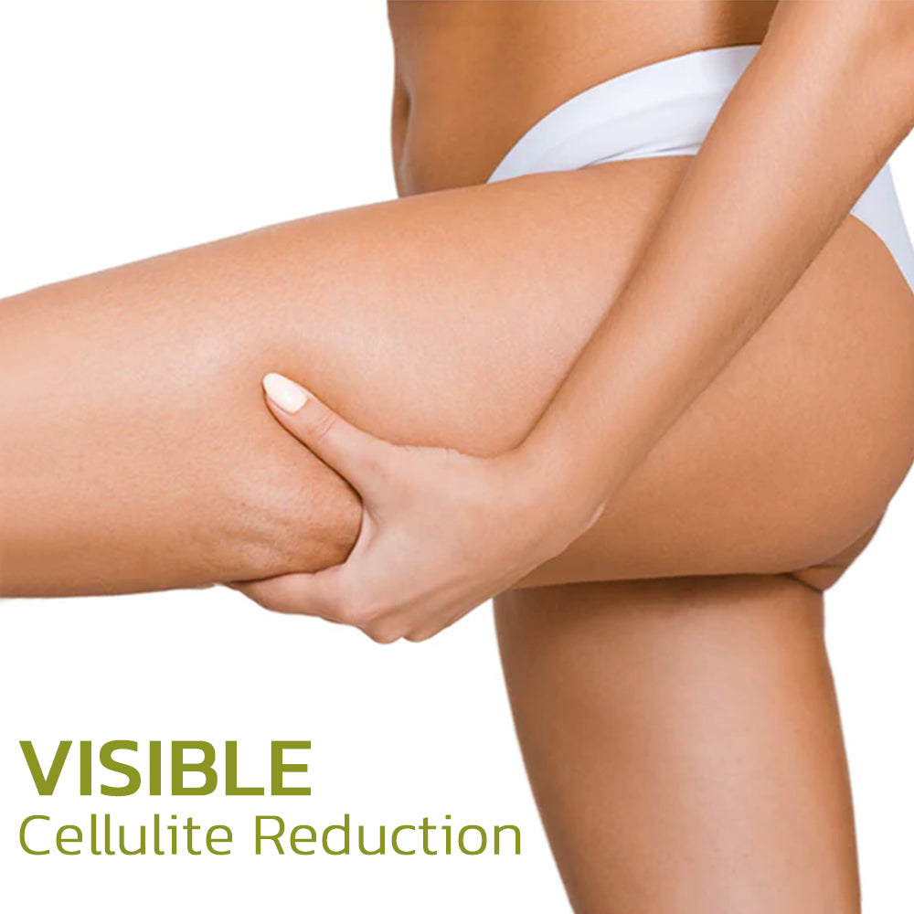 CelluSmooth™ Cellulite Reduction Solution