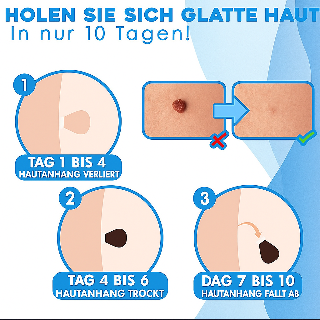 Derma Roller Pro – Say Goodbye to Unwanted Skin Growths