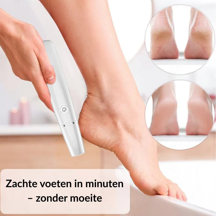 Electric Foot Callus Remover for Smooth Heels