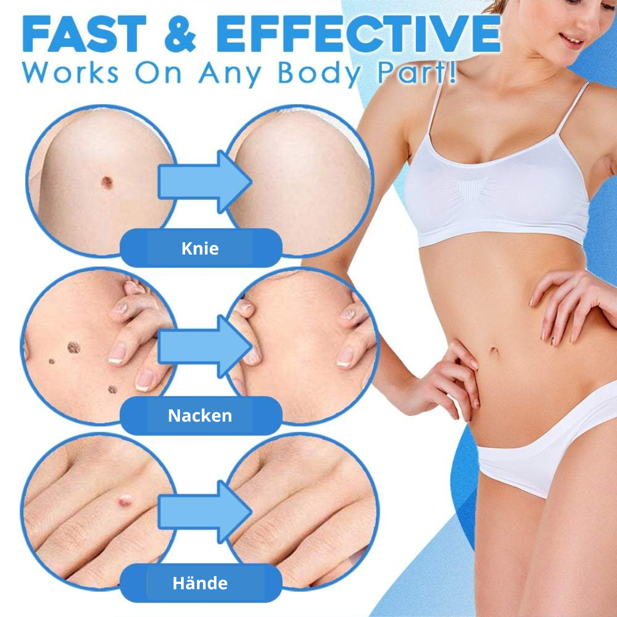 Derma Roller Pro – Say Goodbye to Unwanted Skin Growths