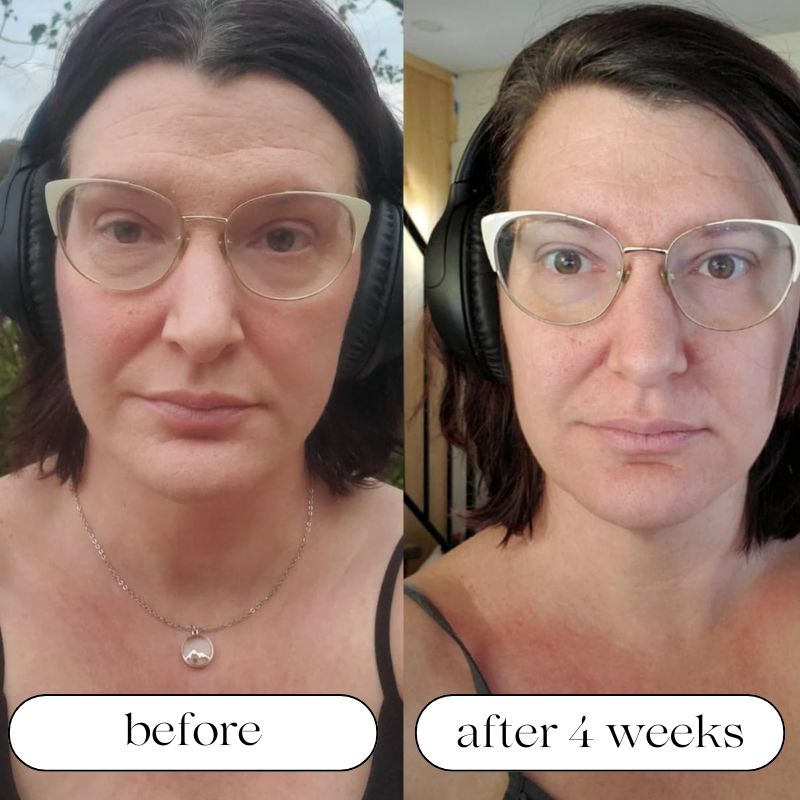 LED Light Therapy Device for At-Home Skin Treatment
