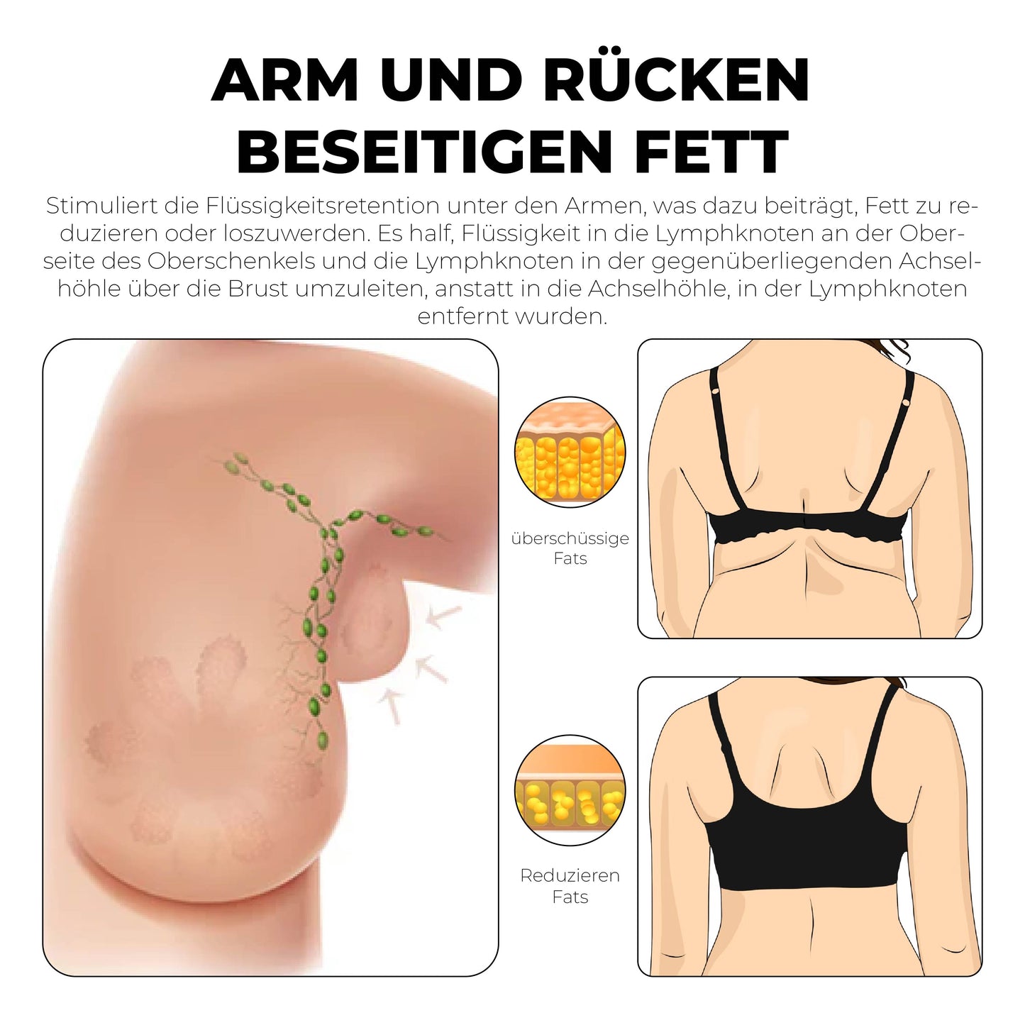 Lymph Care Tourmaline Fiber Bra
