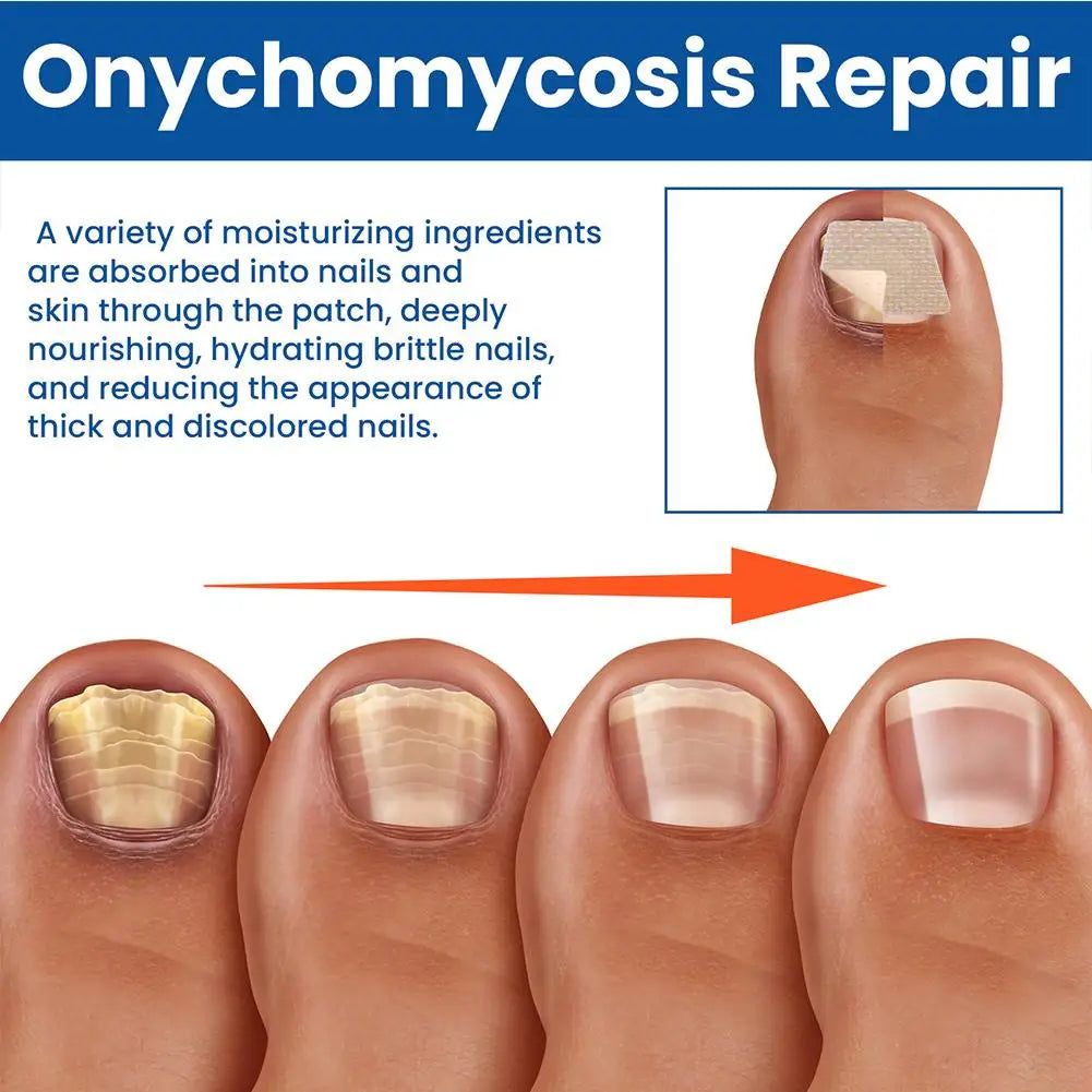 HealthyNail Fungal Nail Restoration Patches - Restore Clear, Healthy Nails Discreetly