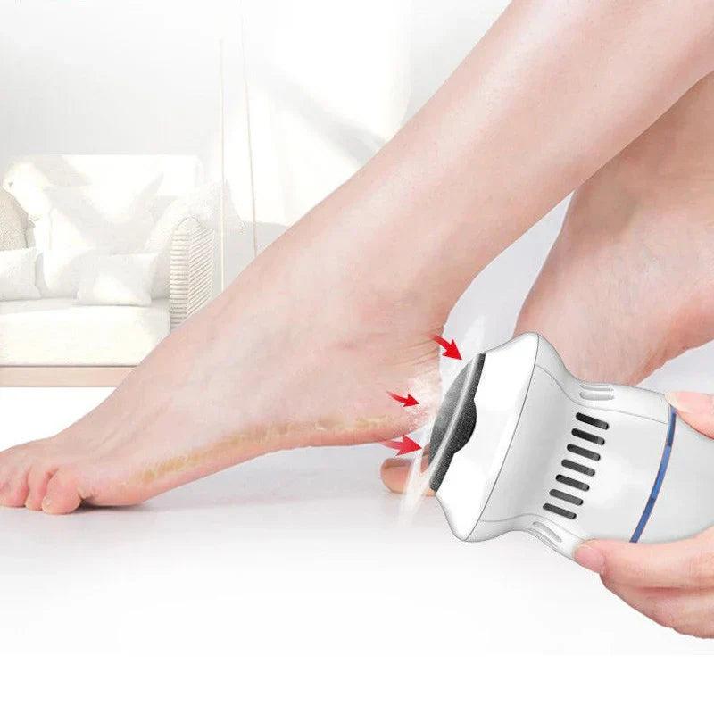Efficient Electric Callus Remover for Smooth Feet