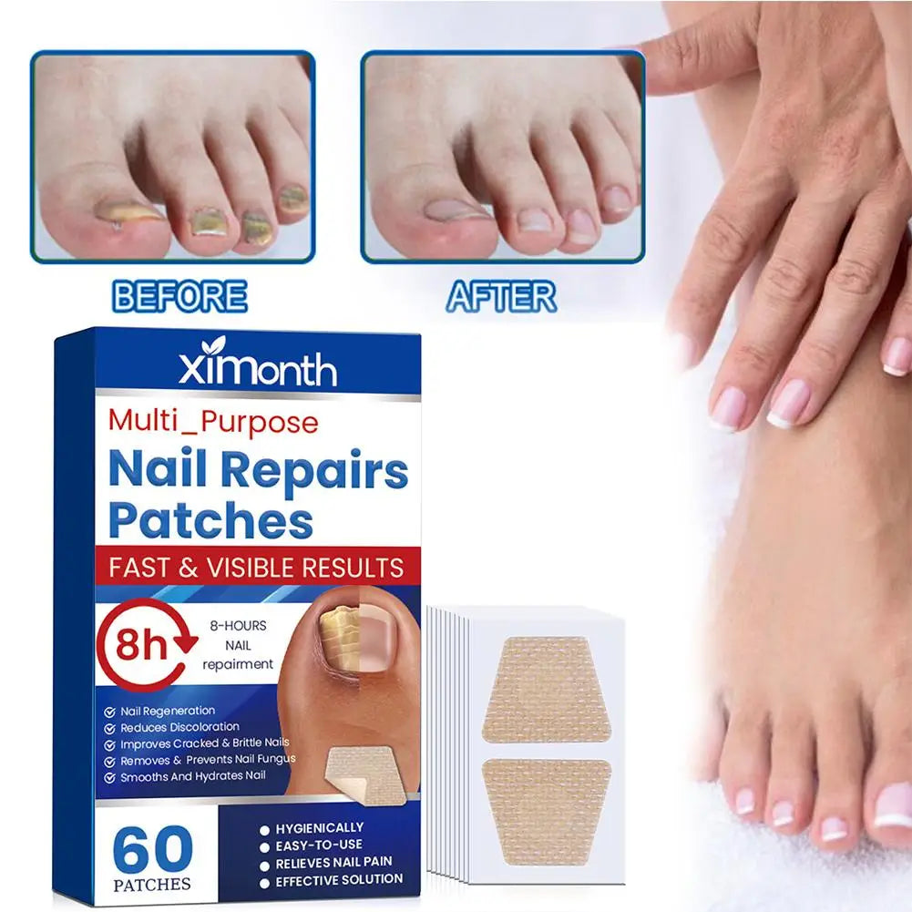 HealthyNail Fungal Nail Restoration Patches - Restore Clear, Healthy Nails Discreetly