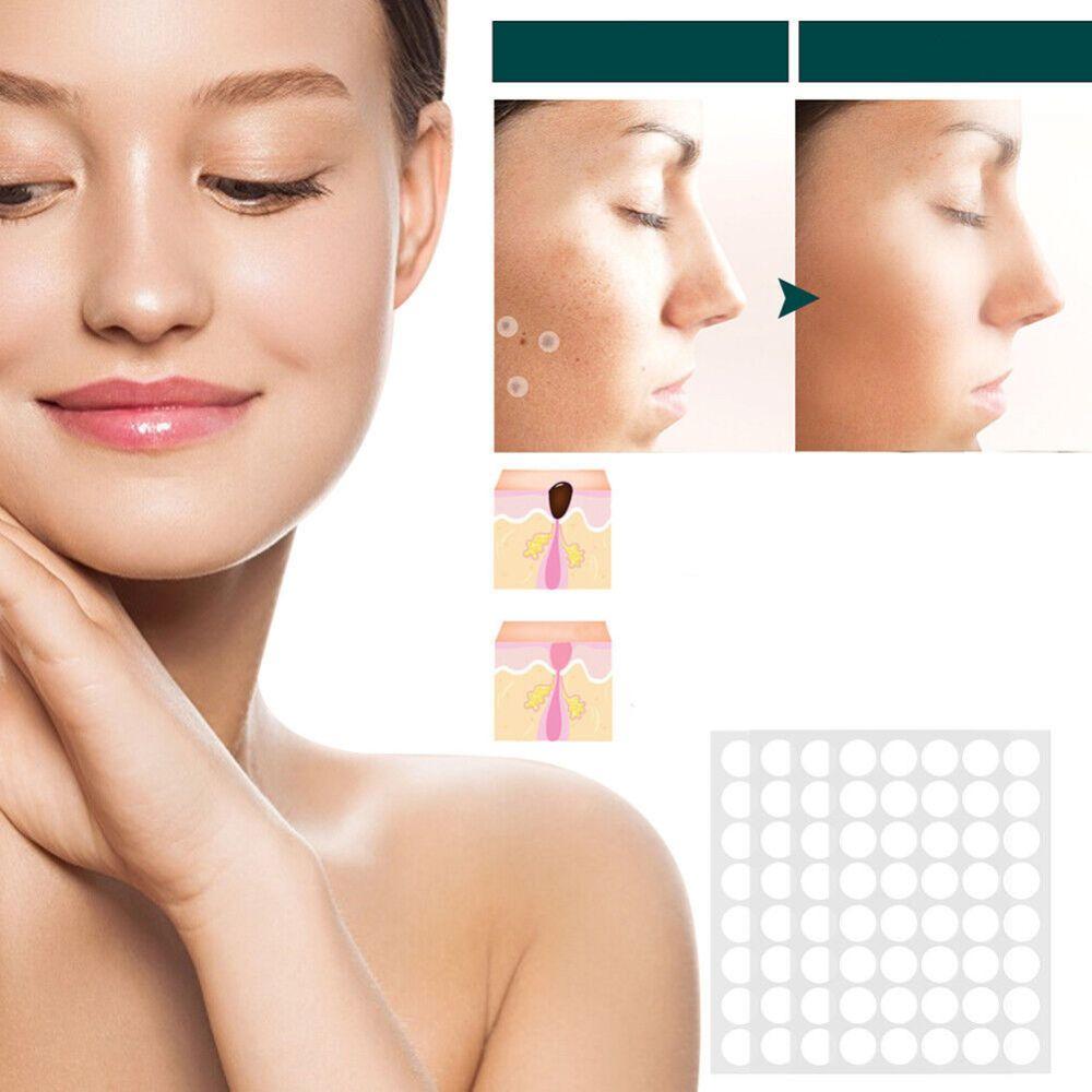 SkinClear - Patch for the removal of spots and warts