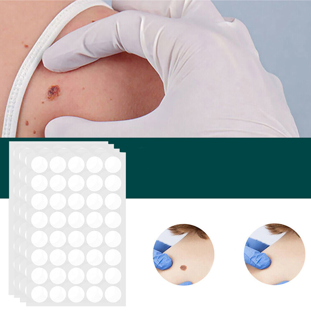 SkinClear - Patch for the removal of spots and warts