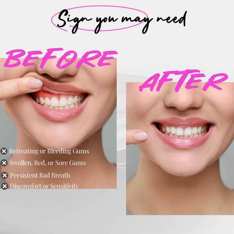 Gentle Dental Care Device for Gum Treatment with Red Light Therapy