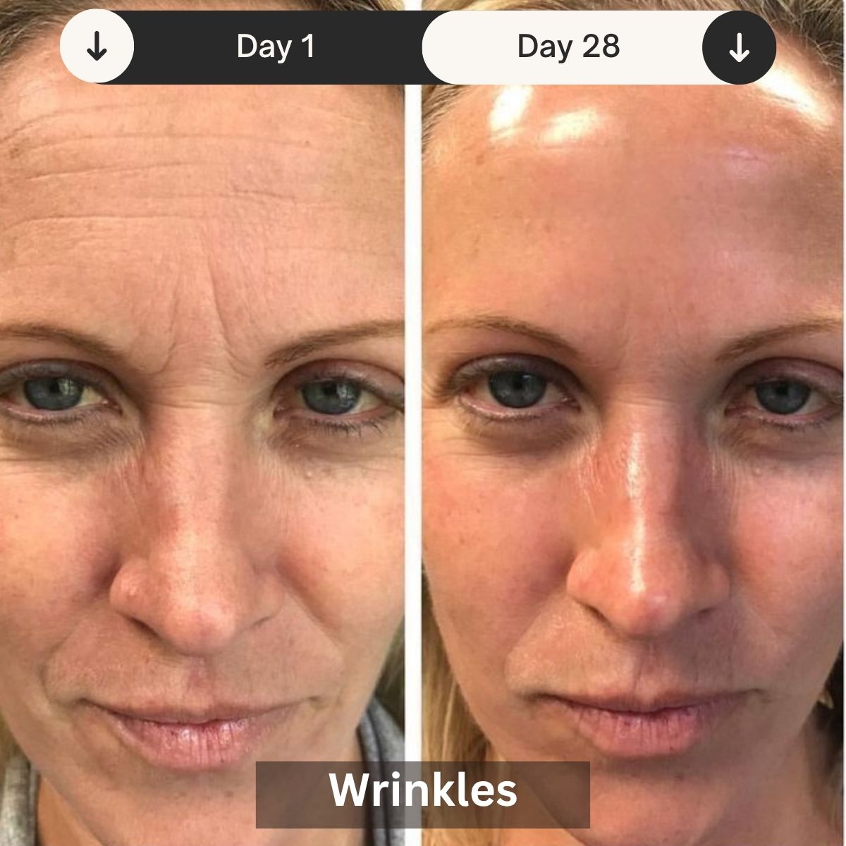 LED Skin Rejuvenation Therapy Device for Professional Use