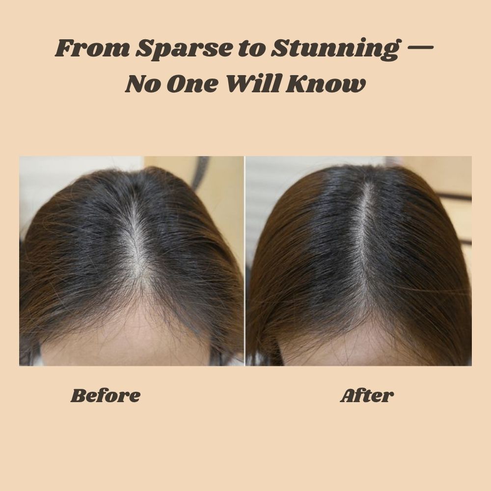 FolliBurst™ — Instantly Transform Thinning Hair into Full-Bodied Confidence