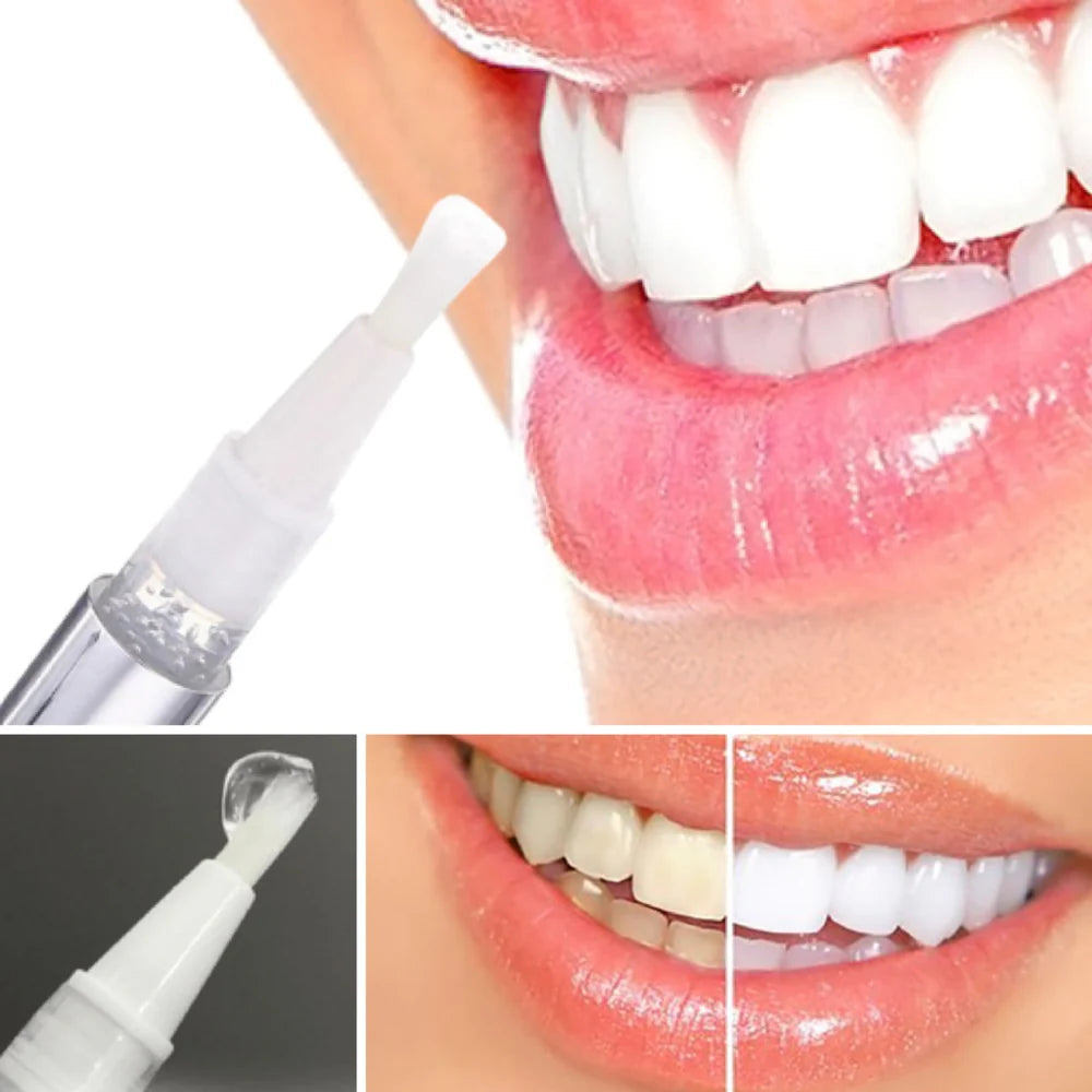 LumaLux — Instantly Boost Your Confidence with a Brighter, Radiant Smile