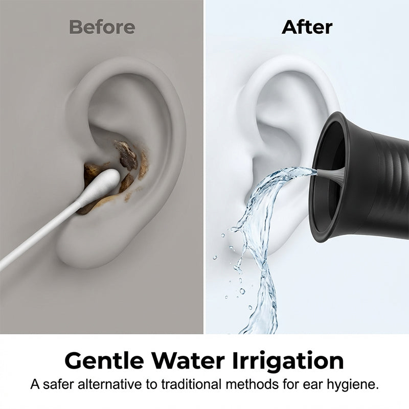 AuraPure™ — Experience Effortless Ear Freedom with Soothing, Spotless Precision