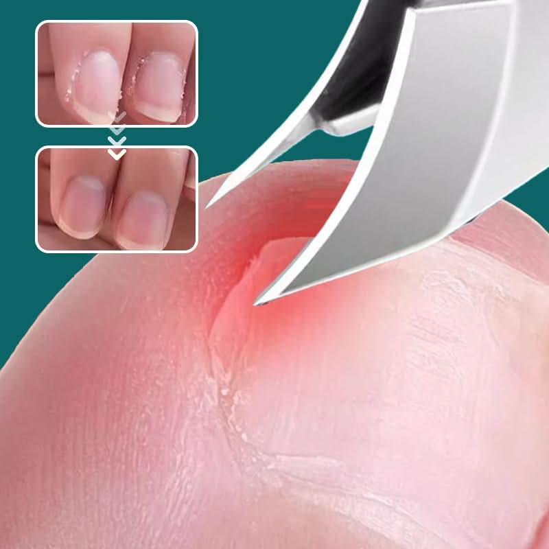 NailGuard — Achieve Smooth and Neat Nails Anytime, Anywhere