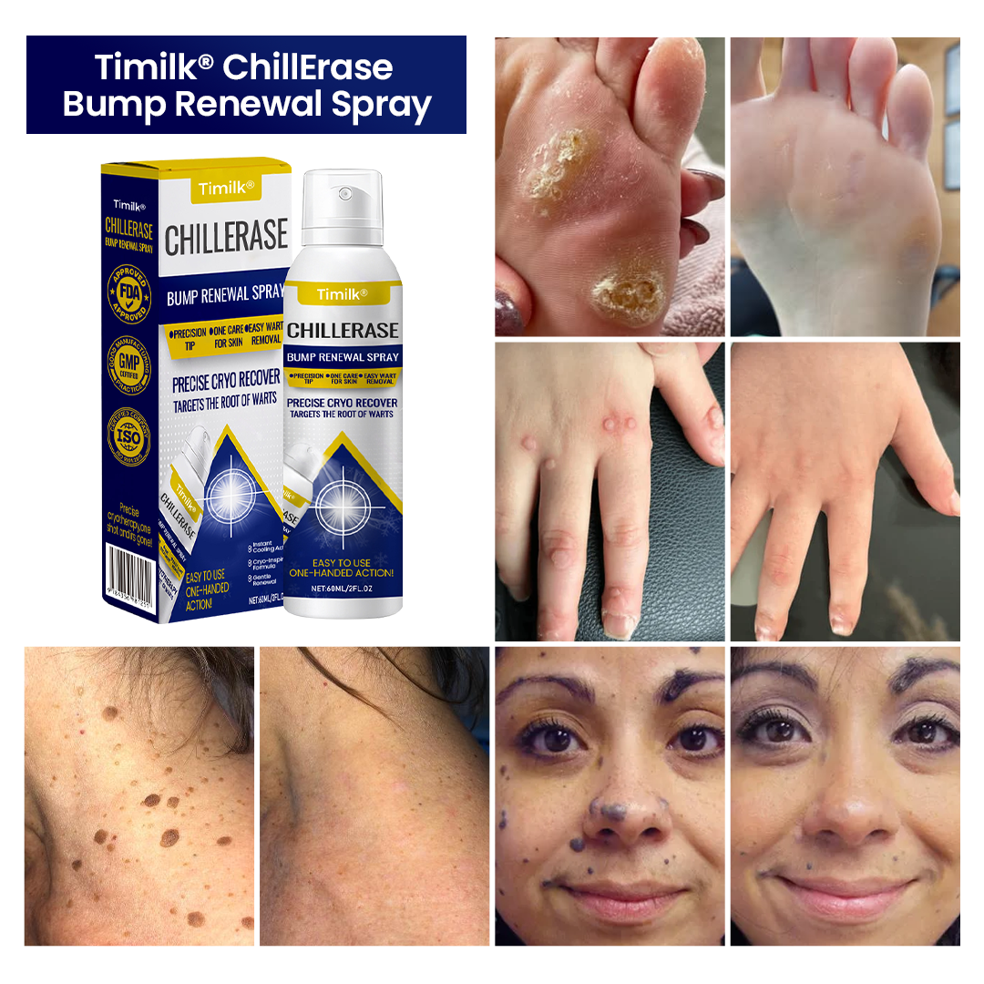 FrostMist — Chill Away Bumps and Unleash Silky, Touchable Skin Fast