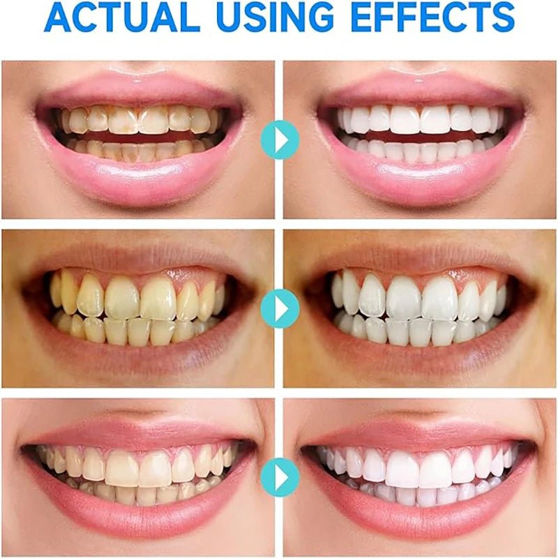 LustraShine — Ignite Unstoppable Confidence with a Brilliant, Fresh Smile Every Day (1+1 FREE TODAY!)