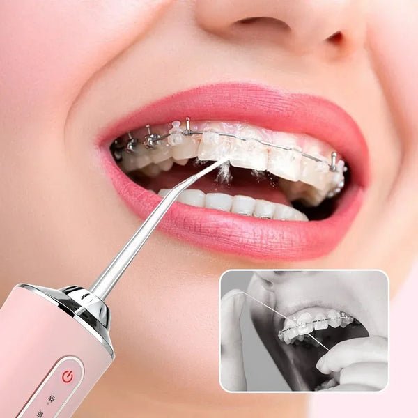 Gentle Plaque Remover for a Bright and Fresh Smile