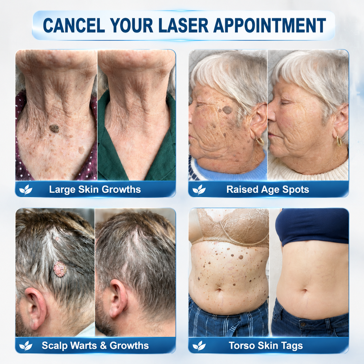 GlowVive — Reveal Radiant, Blemish-Free Skin in Just 7 Days Without Pain or Scars