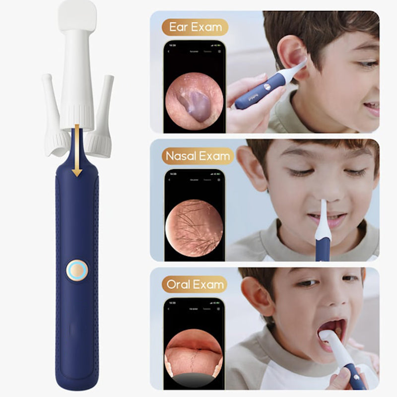 Gentle Ear Care with Safety and Full Control – AurixVue