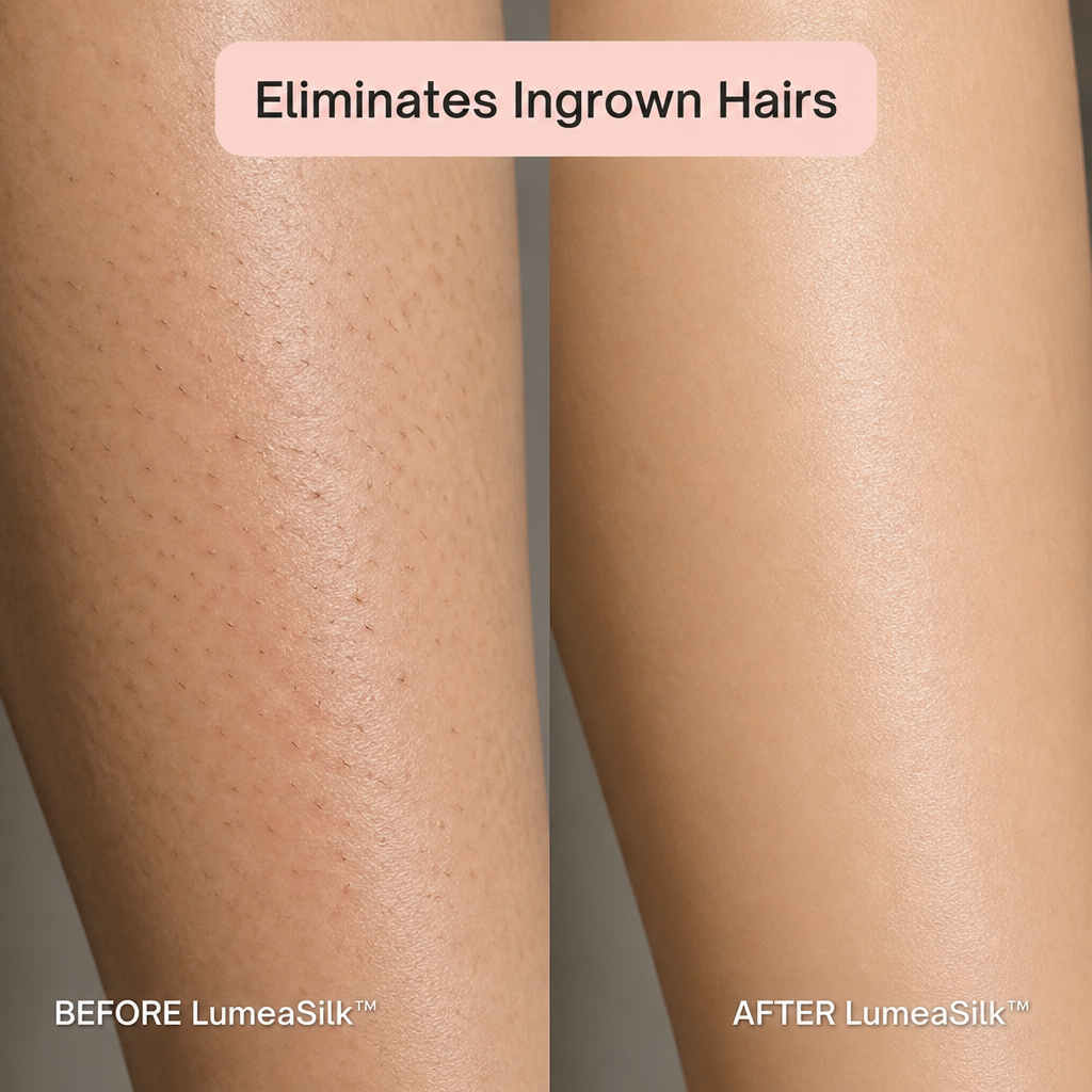 LumeaSilk™ — Shave the Bikini Line Without Nicks, Burns, or Ingrown Hairs