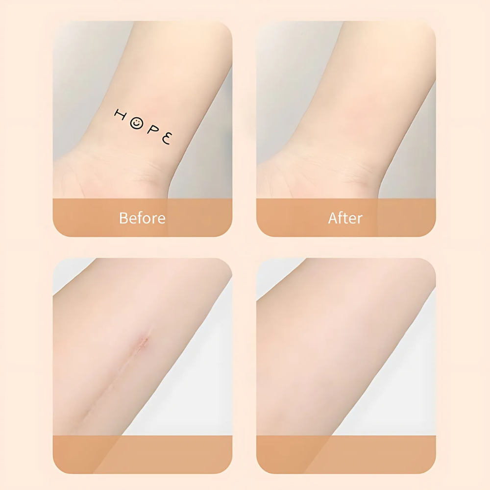 Scar Concealer Patch Waterproof Skin Cover