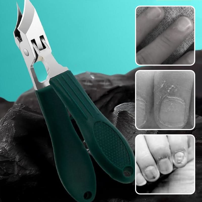 Nail Care Solution – Tidy Nails Without the Mess