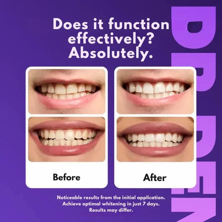 TrueWhite - A perfect smile in just 30 minutes - BrinoaTrueWhite - A perfect smile in just 30 minutesTrueWhite - A perfect smile in just 30 minutes